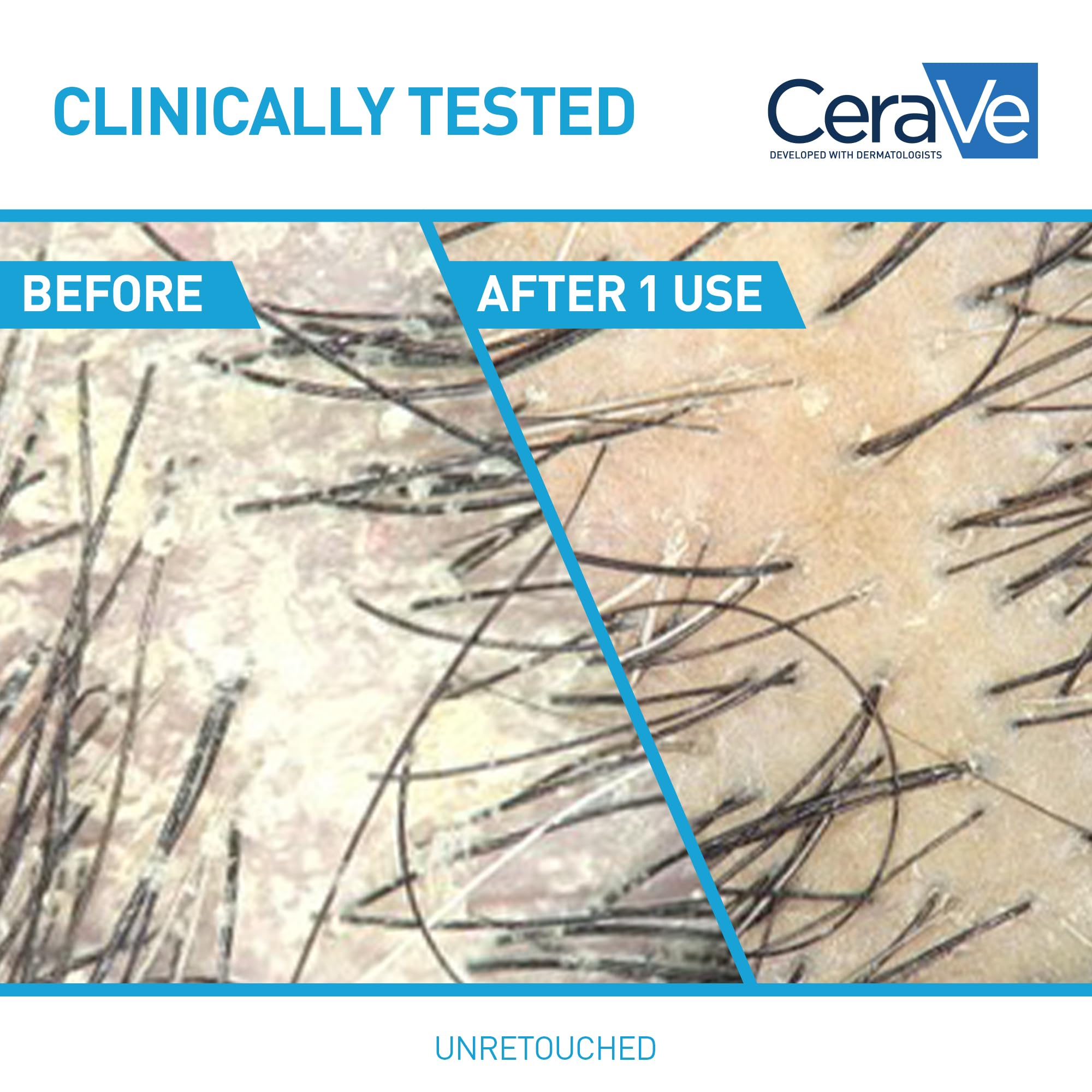 CeraVe Hydrating Anti Dandruff Shampoo and Conditioner Set, Pyrithione Zinc Dandruff Treatment With Ceramides, Hyaluronic Acid & Niacinamide, Helps Elimanate Flakes & Reduce Itchy Scalp - Image 3