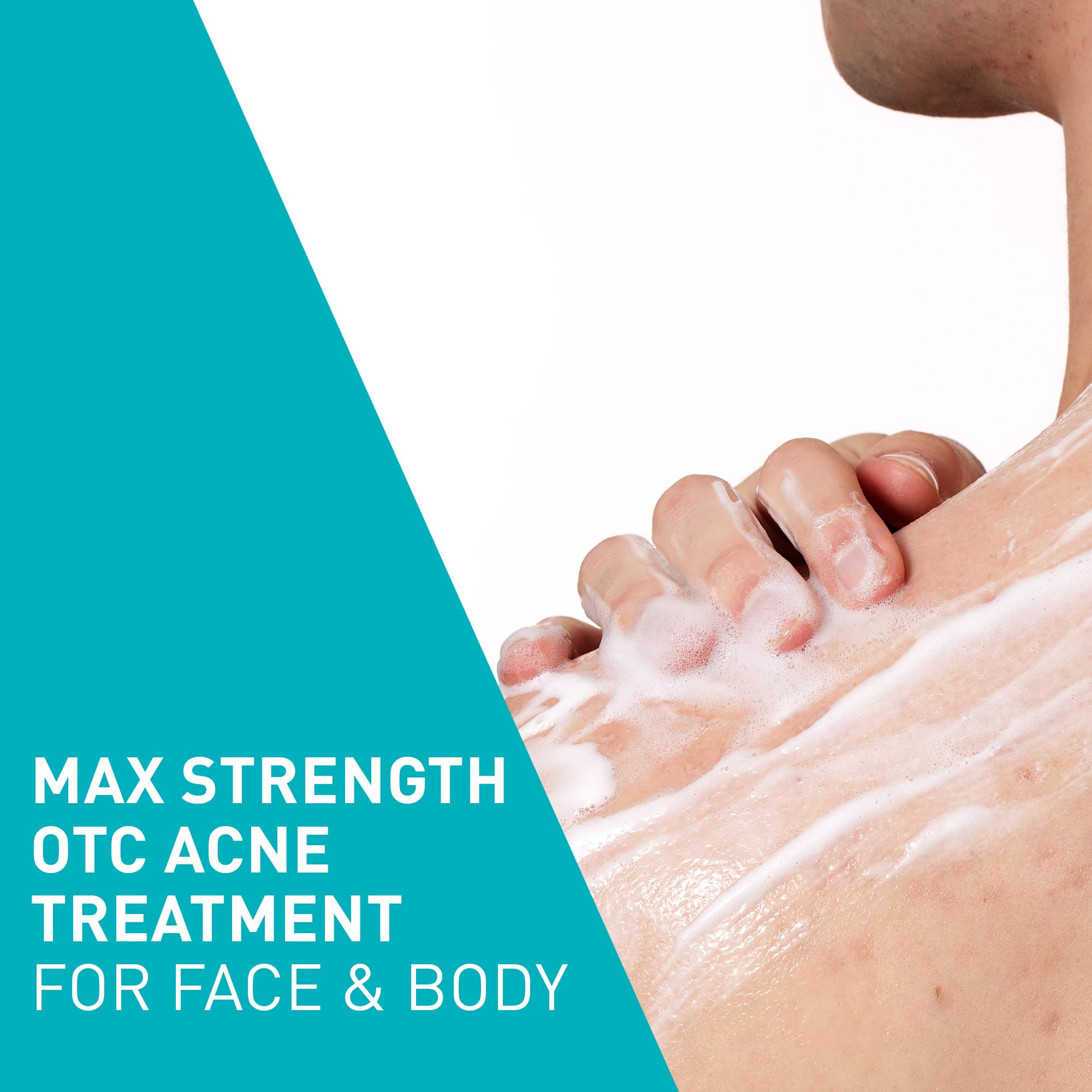 CeraVe Acne Foaming Cream Wash, Gentle Face and Body Cleanser with Benzoyl Peroxide 10%, Hyaluronic Acid, and Niacinamide, 10% Benzoyl Peroxide Treatment Clears Pimples and Blackheads 5 Oz - Image 5