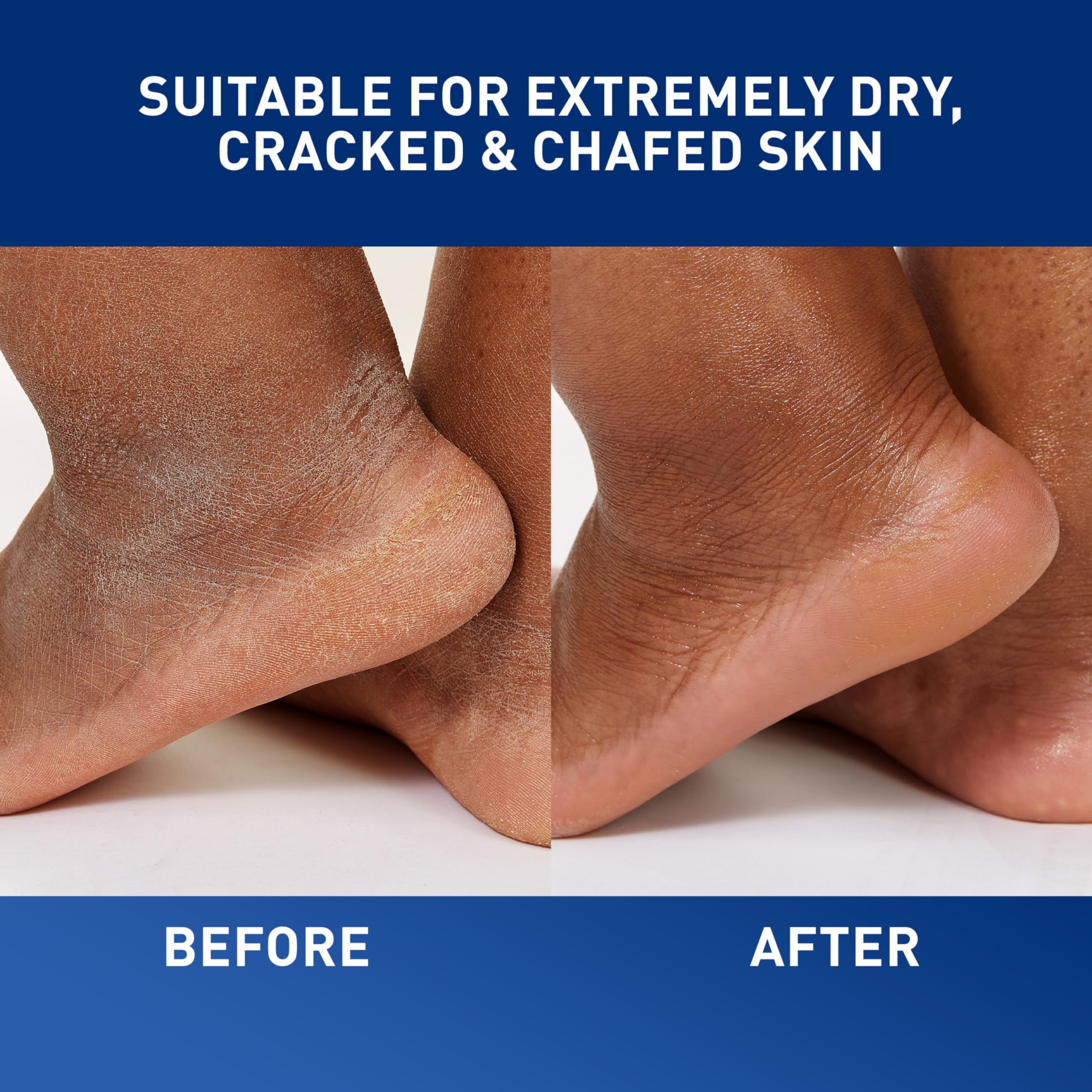 CeraVe Healing Ointment, Hydrating Skin Protectant With Petrolatum, Hyaluronic Acid & Ceramides, Face & Body Skin Barrier Repair For Cracked, Chafed, Dry Skin, Fragrance Free & Lanolin Free, 3 Oz - Image 5